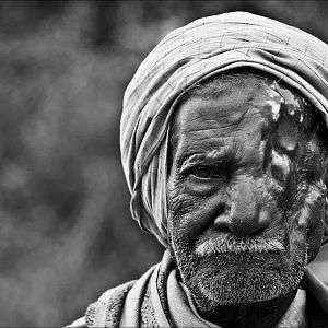 Indian farmer that has survived a bear mauling