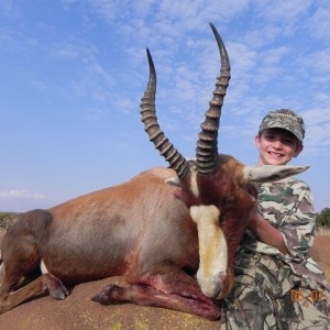 Blesbok