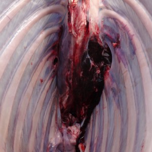 oryx wound channel