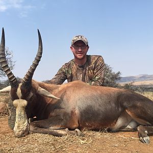 Blesbok Hunt in South Africa