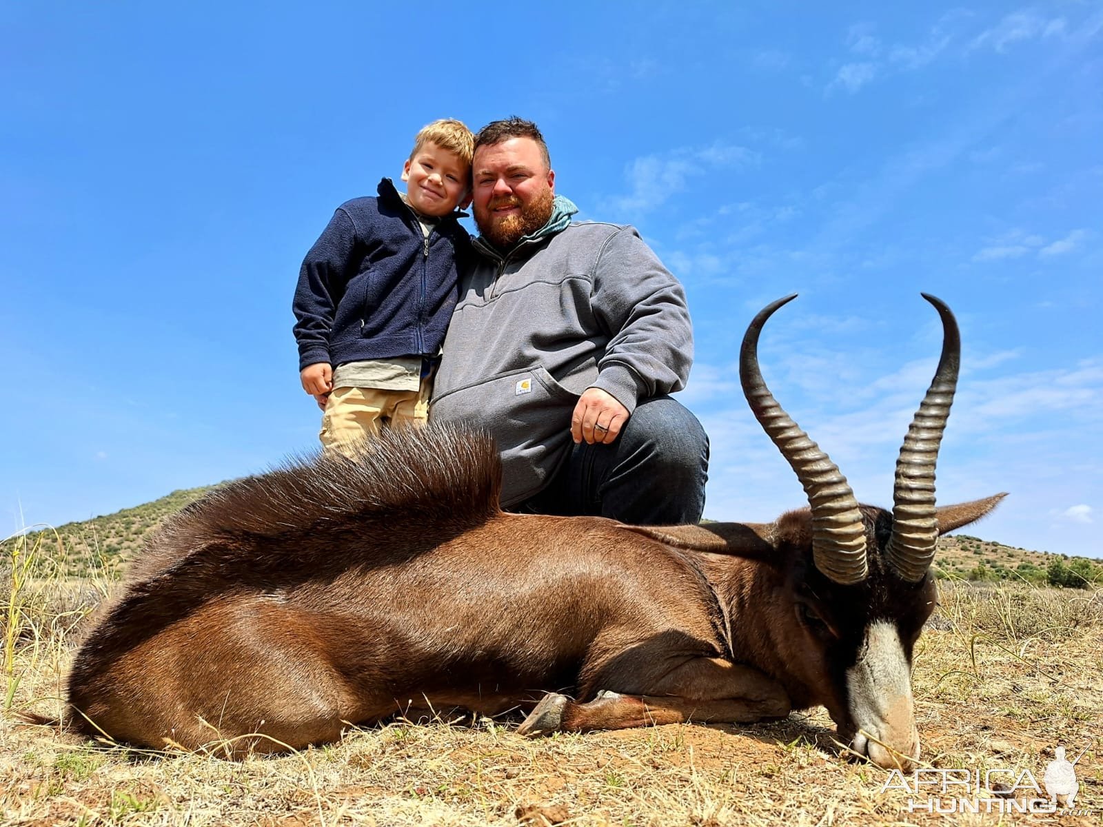 Black Springbuck Hunt South Africa