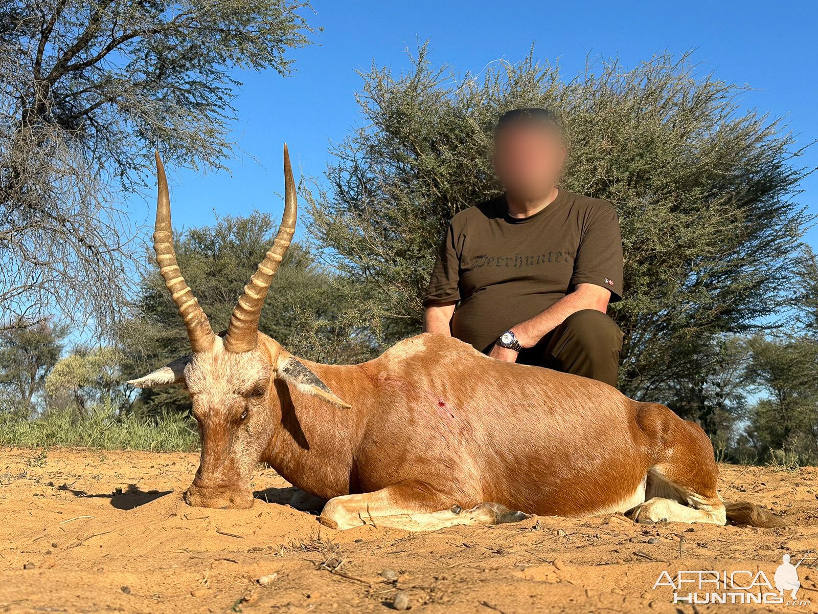 Blesbok Hunt South Africa