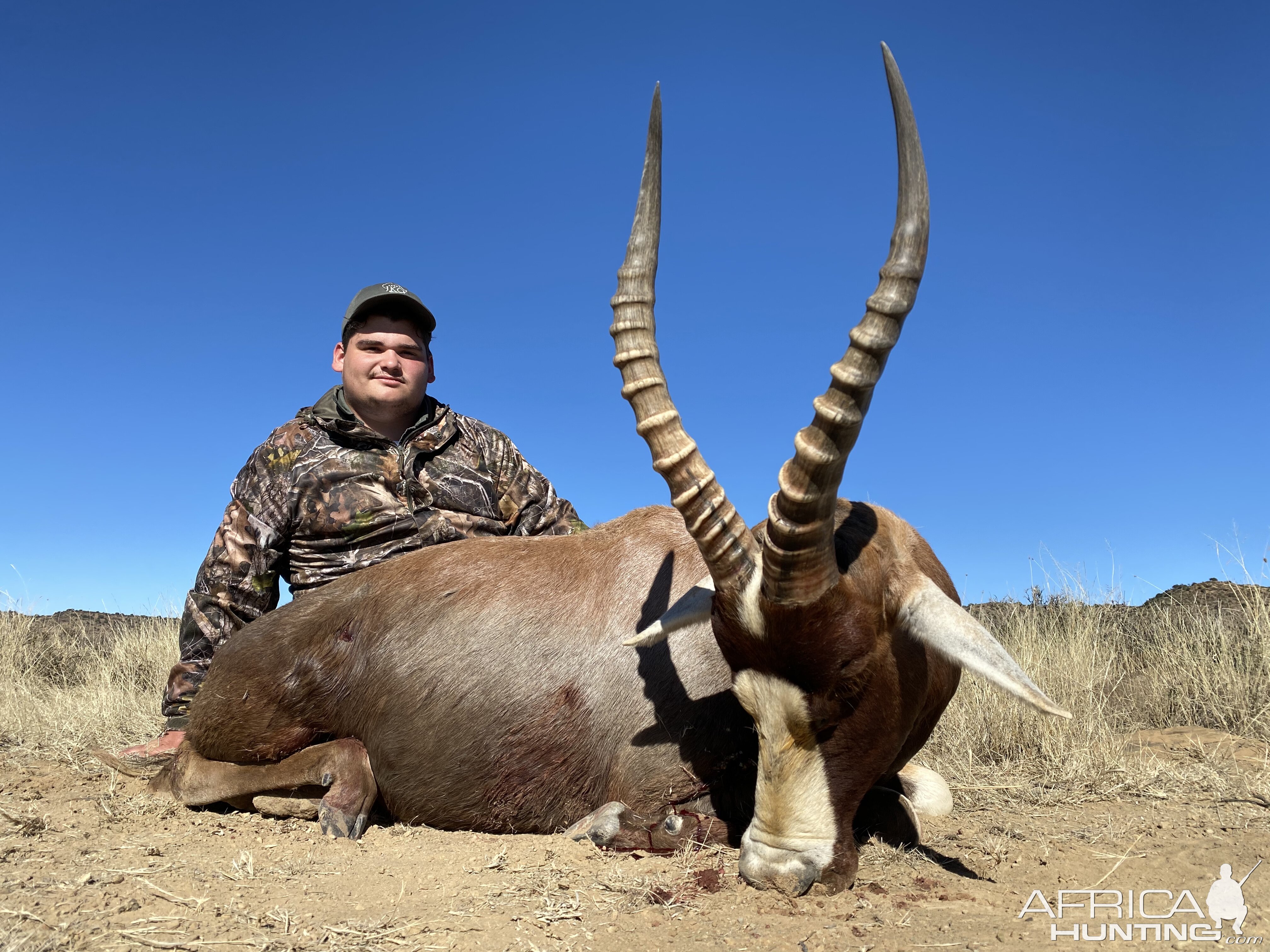 Blesbok Hunting South Africa