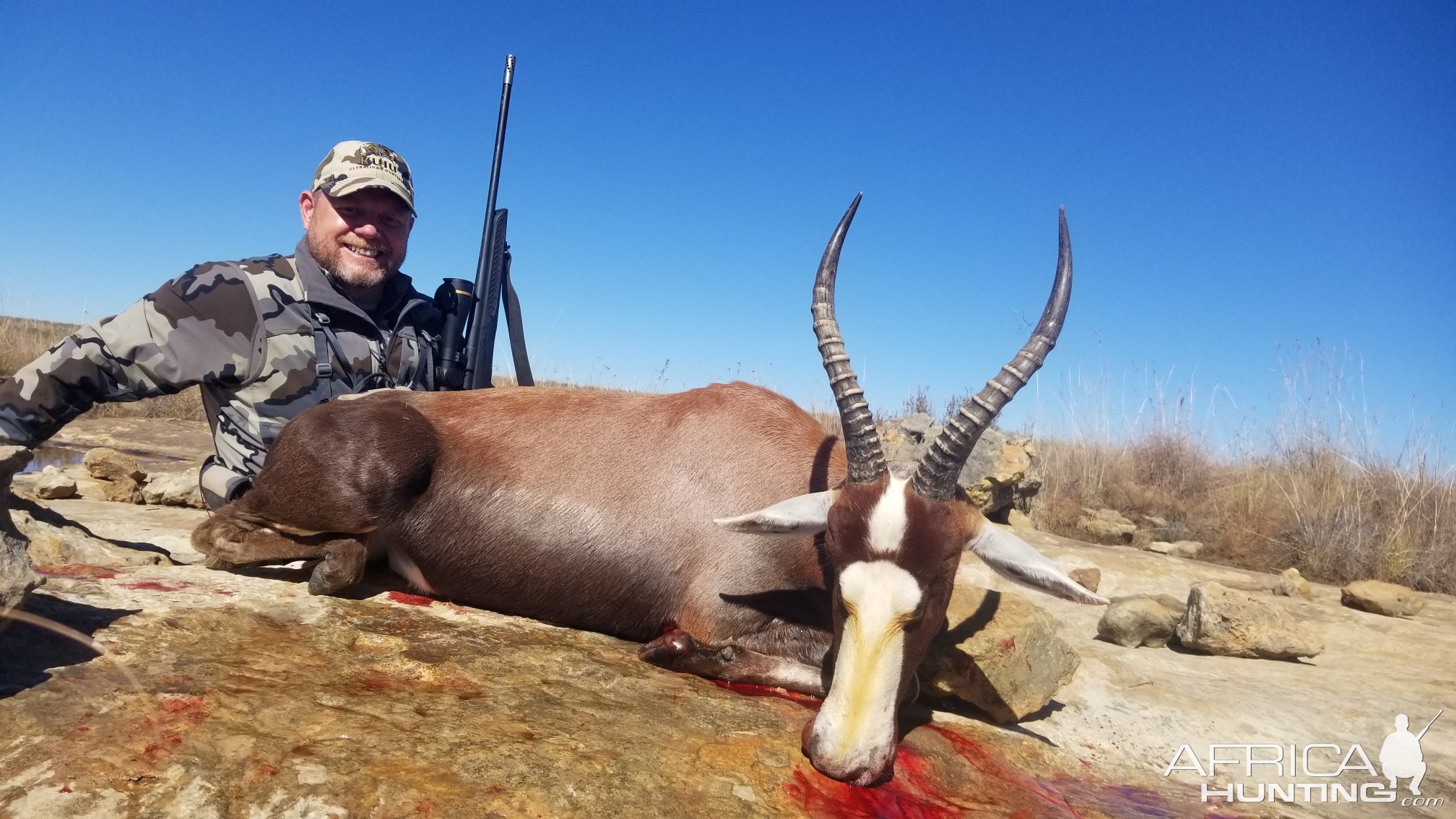 Blesbok Hunting South Africa